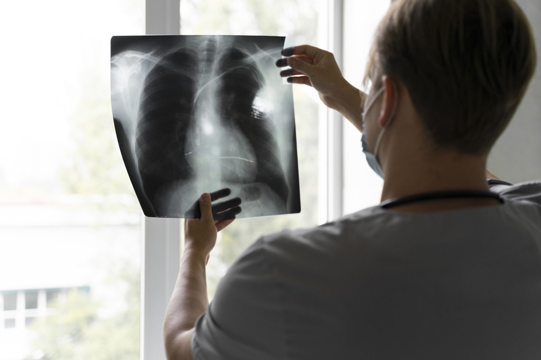 pneumologue regarde radio des poumons