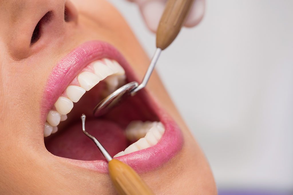 Contrôle dentaire d'une femme par le dentiste